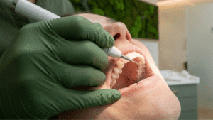 moss dental tooth checkup and cleaning
