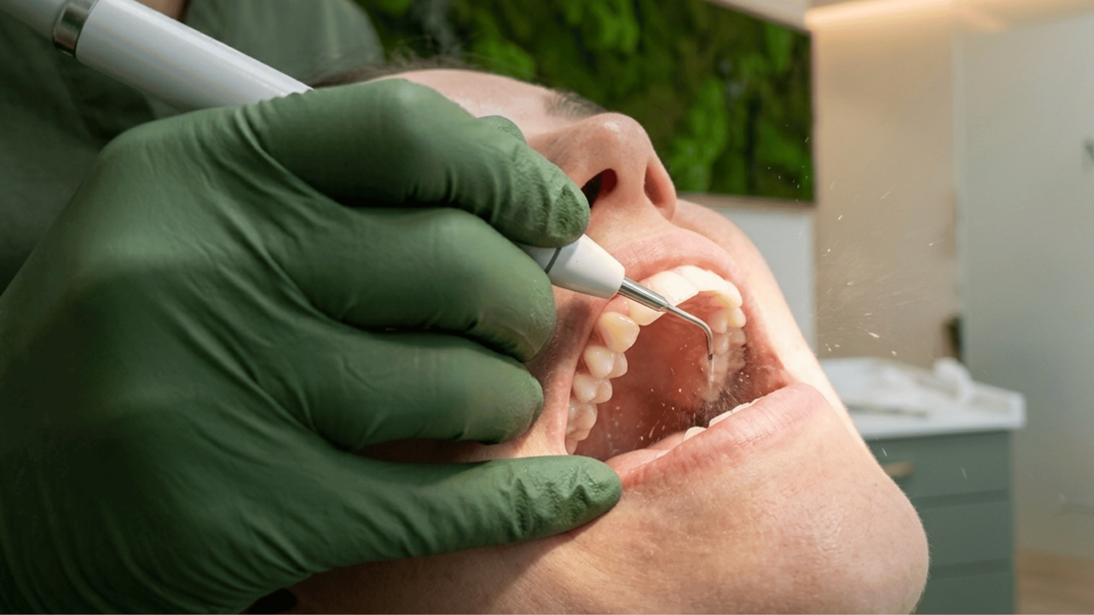 moss dental tooth checkup and cleaning