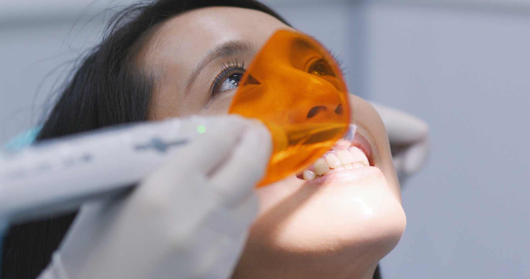 Dental restoration material cured with a polymerization light