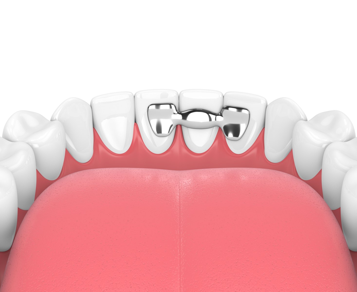 3D dental illustration of teeth and jaw anatomy
