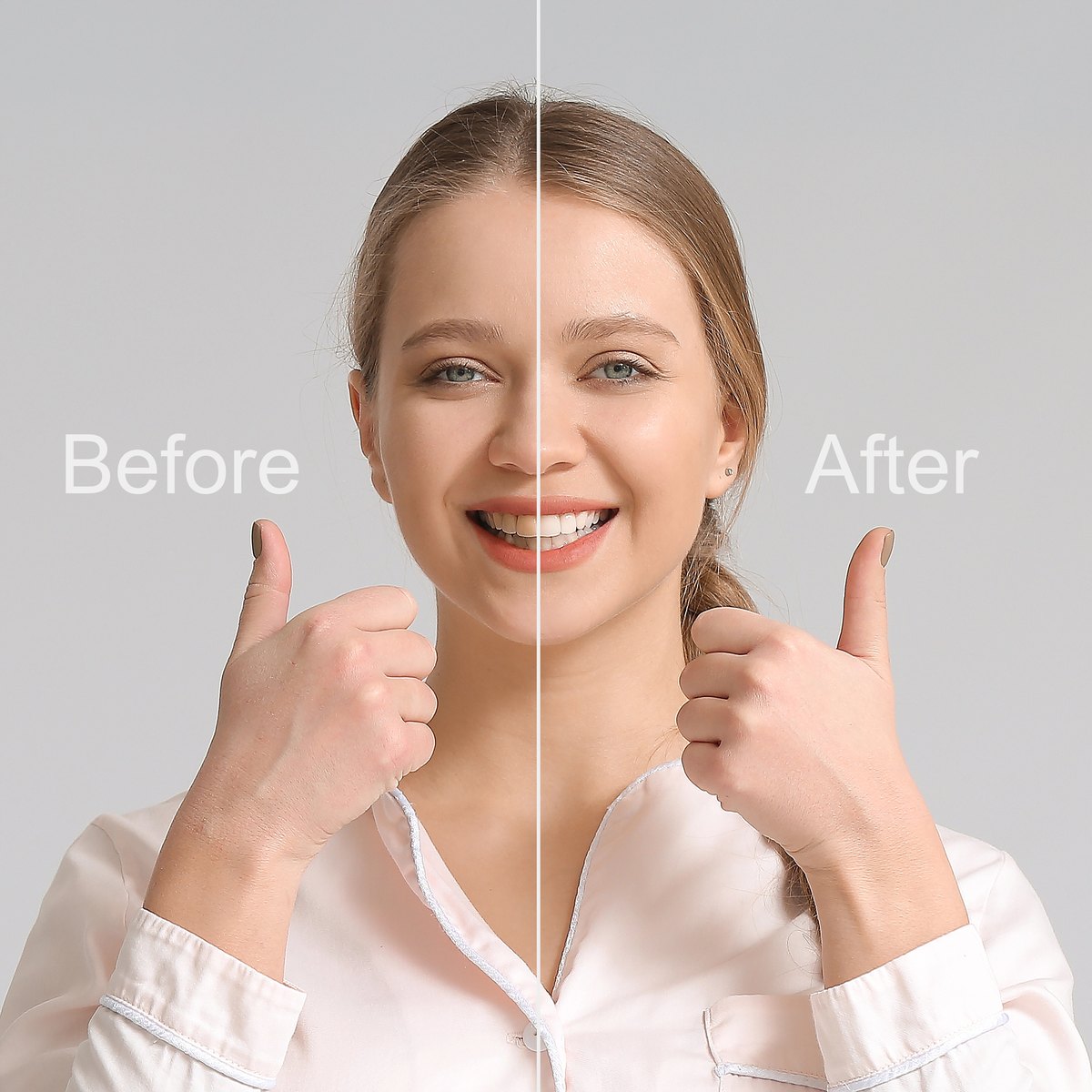 Woman shown before and after a cosmetic smile change