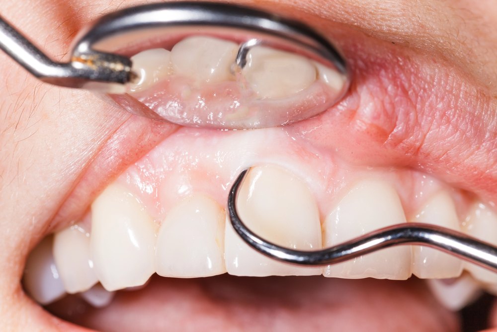 Dentist performing a dental examination