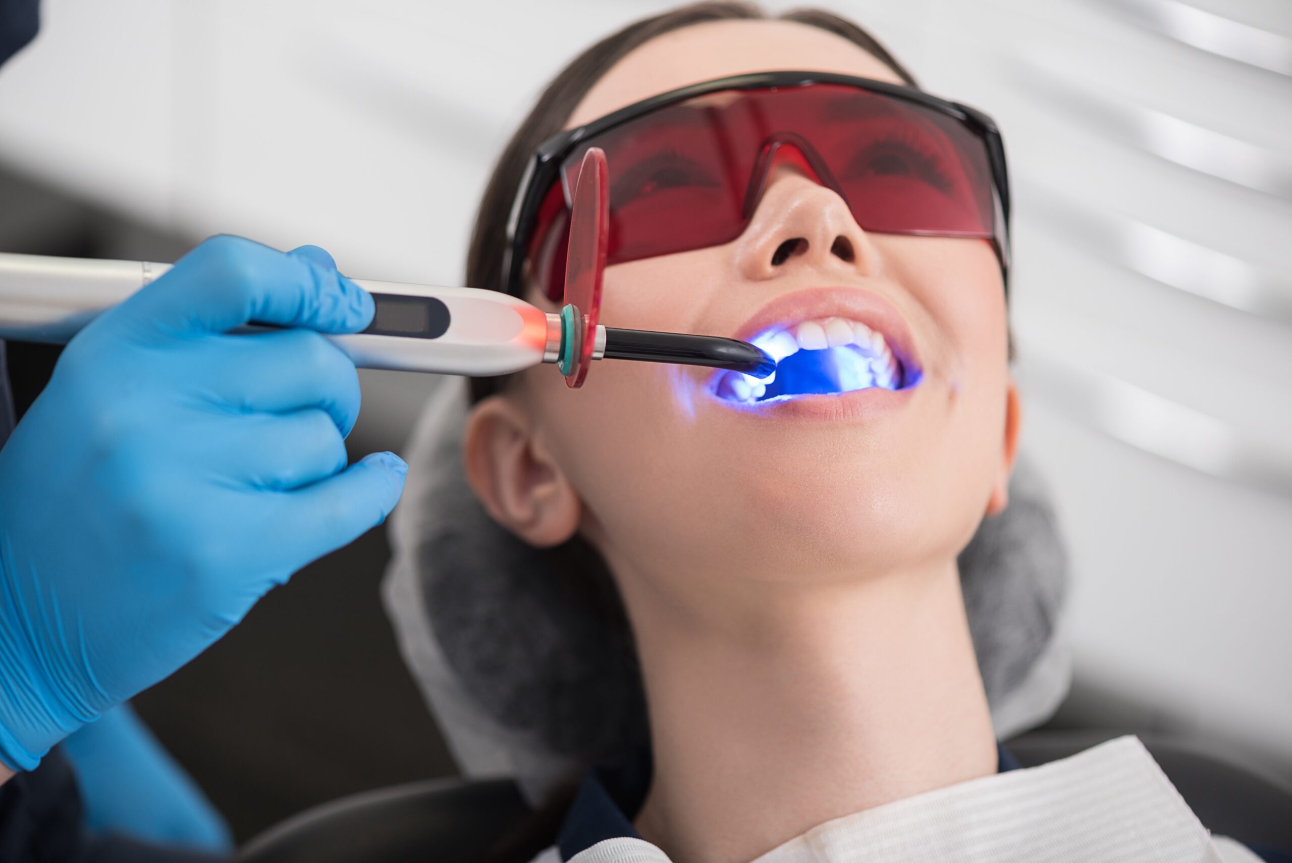 Dental Sealants