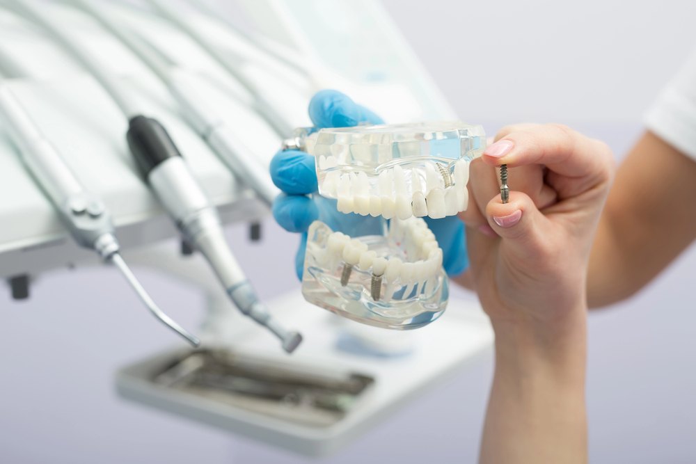 Dental implant model used during treatment planning